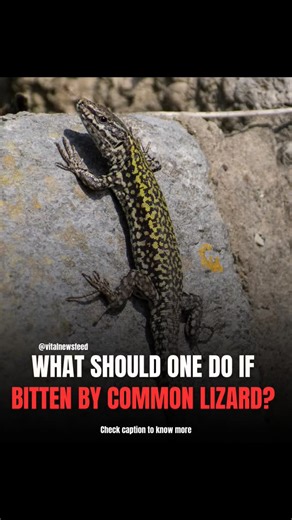 Global Health Dispatch on Instagram: "What To Do If a Common Lizard Bites You? Most house lizards are non-venomous and usually harmless, but proper care is still important. Here’s what to do: • Stay calm, common wall lizards don’t carry venom. • Wash the wound thoroughly with soap and water. • Apply antiseptic to prevent bacterial infection. • Monitor for symptoms like redness, swelling, fever, or pain. • Seek medical care if symptoms persist or if the bite is from a larger/exotic species. Why t