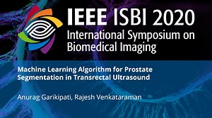 Machine Learning Algorithm for Prostate Segmentation in Transrectal Ultrasound