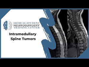Intramedullary Spine Tumors