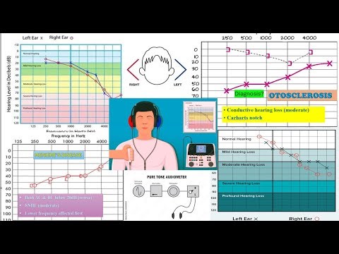 Pure Tone Audiometry (PTA) part 2