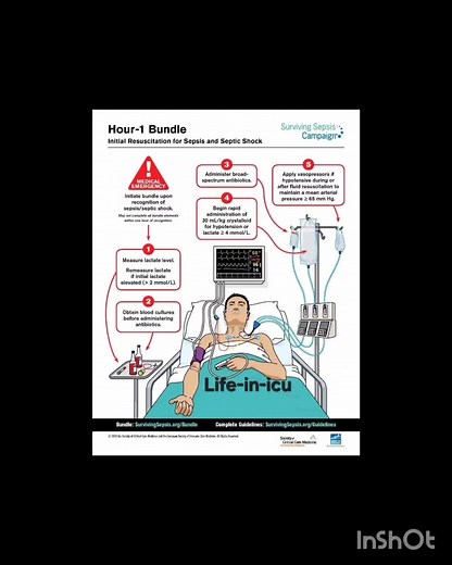 4.4K views · 34 reactions | Life-in-icu  follow for more clinical...