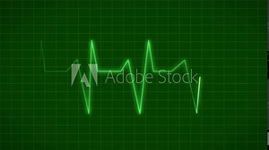 ECG Electrocardiogram Display Heart Rate Beat Pulse Looped animated background.