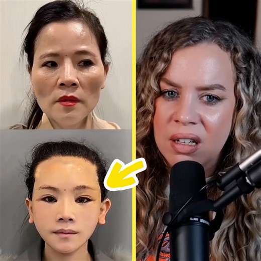The plastic surgeon turning adults into scary children