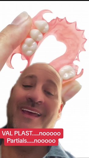 disadvantages of partial plastic bridges, commonly known as balplast. These devices can have significant limitations and are not considered an ideal long-term option. Here's why: 1. Bone resorption: Partial plastic bridges do not provide adequate stimulation to the alveolar bone, which can lead to bone resorption. Over time, this can result in a decrease in bone volume and compromise the stability of adjacent teeth. 2. Periodontal problems: Prolonged use of partial plastic bridges can make prope