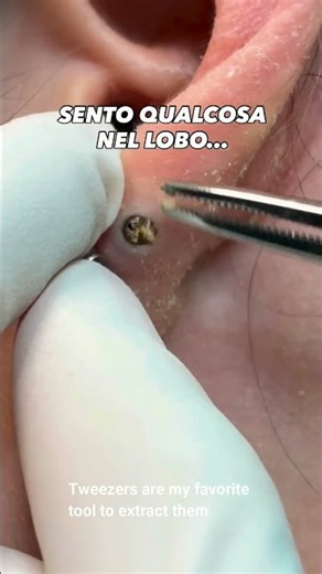Tweezers are my favorite tool to extract them