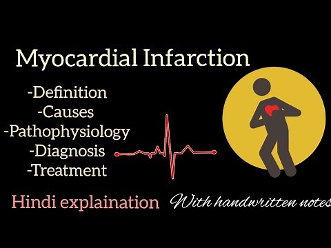 Myocardial Infarction | Heart Attack | Definition | Symptoms | Pathophysiology | Treatment |