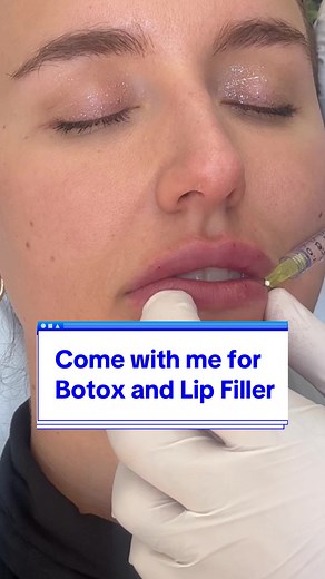 Replying to @laurenb4985 lip filler and botox dysport before and after in nyc. The special trick for a keyhole pout and lip cleavage from @vafaMD. I pay for this service and his rate is competive compared to what ive been quoted. #botox #dysport #lipfiller #lipfillercheck #keyholepout #lipfillers