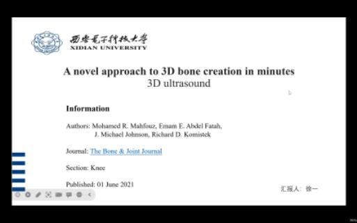 3D Ultrasound*3D超声