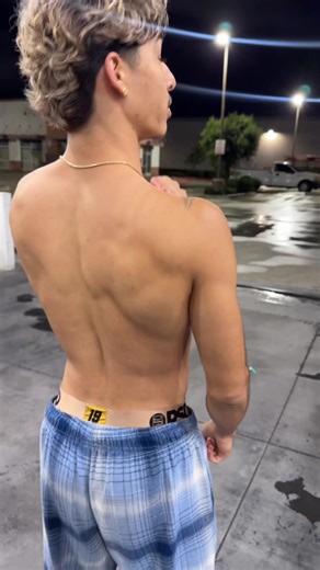 Benefits of Cupping Therapy for Athletes