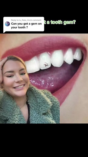 Tooth Gems: Trendy or Risky Decision?