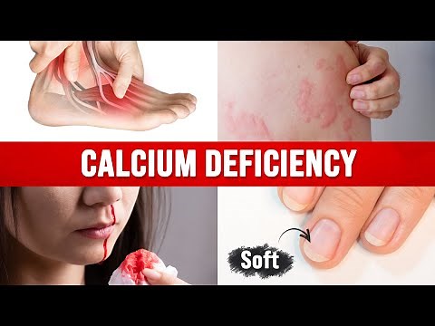Best Home Test for a CALCIUM DEFICIENCY