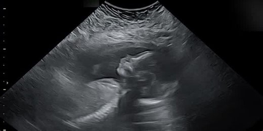 WVLT’s Will Puckett expecting first child