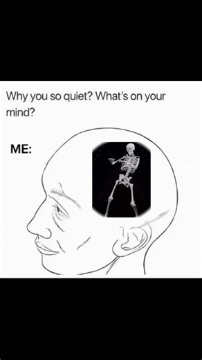 You’ve Never Learned Bones Like THIS 😂🦴 #shorts #medical #funny