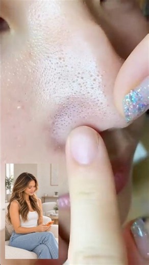 BLACKHEAD REMOVAL: WHAT REALLY WORKS? 😱