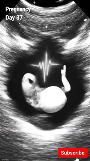 Ultrasound View 👶 | Pregnancy Day 29 (Week 4) #shorts #viralvideo