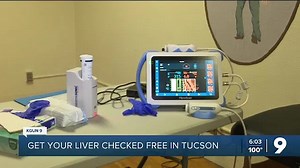 Get your liver health checked for free in Tucson