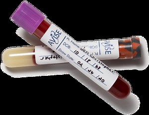 Advanced Diagnostic Test for Systemic Lupus Erythematosus