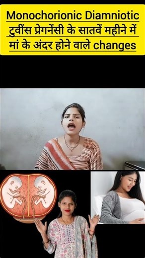 monochorionic Diamniotic twin pregnancy ke 7 month me maa me hone wale changes MCDA twins pregnancy
