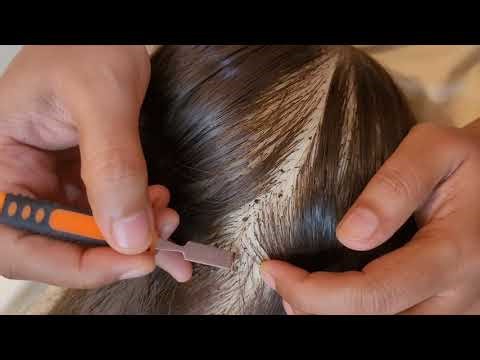 🌛Deep Scalp Scratching ASMR For Sleep And Tingles 💤😴, Scalp Check and Treatment#asmr #asmrforsleep