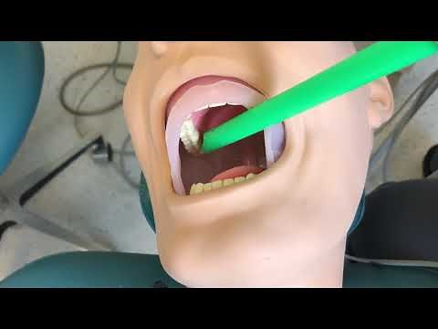 Rinses Skill with HVE Positioning