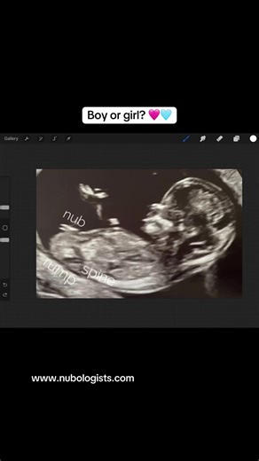 Discover Your Baby's Gender with Nub Theory