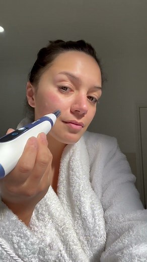 Maybe Dr. Pen A11 Microneedling Pen can be your next best friend? 🌟 #microneedlingtreatment