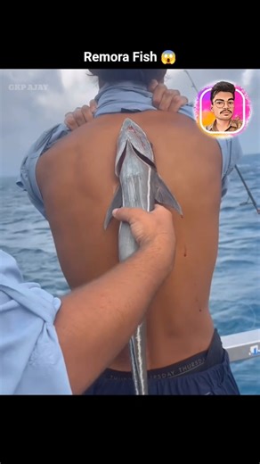 Remora: The ULTIMATE Hitchhiker of the Deep! 🤯 #shorts