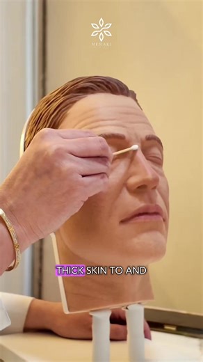 Understanding Skin Thickness and Nose Surgery Recovery