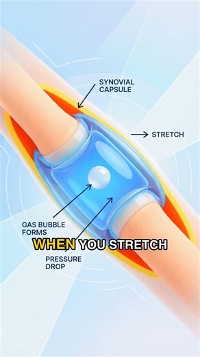 Why do my knuckles make a cracking sound?