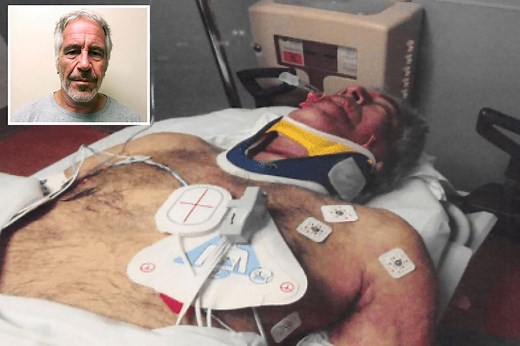 Newly released ghoulish pics show Jeffrey Epstein’s body as EMTs performed CPR after prison suicide
