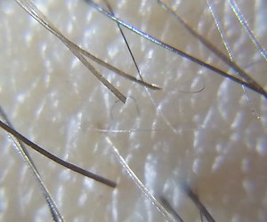 Worlds Easiest Microscope Phone Case