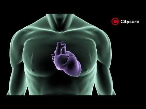 Qu'est ce que la fibrillation ventriculaire ?