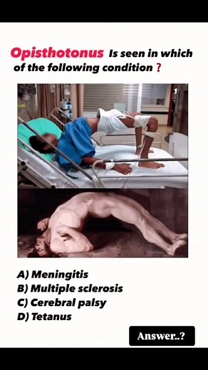 55 reactions · 4 comments | Comment answer 喙❤#bscnursing2025 #nursinglife #nursingcollege #nursing_student #mbbsstudent #mbbsstudy #mbbsdoctor #motivation #motherlove #doctor #science #technology #tecnologia #lifestruggles #lifequotes #respect #relationships #travelphotography #trendingreels #viralreels | Pushpendra Singh | Facebook