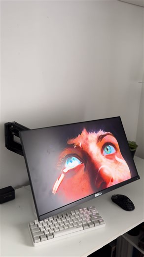 Best xbox setup ?