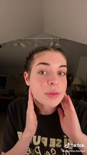 big thank you to all my friends with ICR who let me use their pics as examples❤️❤️ love y’all #fyp #idiopathiccondylarresorption #jawsurgery