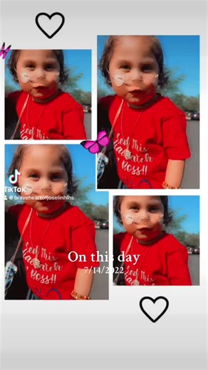 Josie 5th open heart surgery to repair her valve was year 2022 at 3 years old. #chdawarness #openheartsurgery