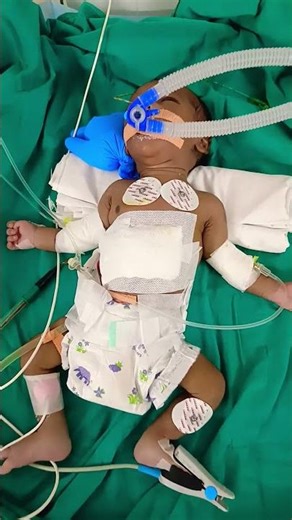 #neonatologist #newbornbaby #cuteanimal #cutebaby #hospital #babypictures #covid #cutestbaby #baby