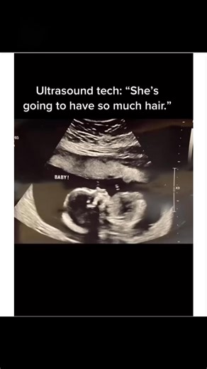 670K views · 1.1K reactions | No, but seriously, that’s boo from Monsters Inc.  - (Via: @iamnancess) | Memes | Facebook