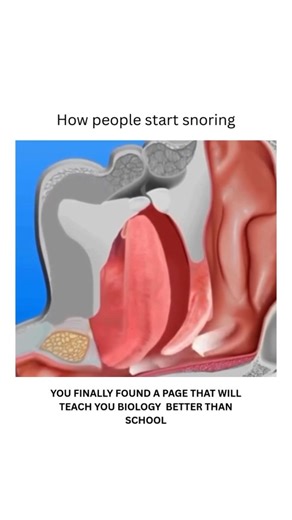 BIOLOGY | MEDICAL | HEALTH on Instagram: "Snoring happens when the flow of air through your mouth and nose is partially blocked during sleep. As you breathe, the tissues in your throat, soft palate, or tongue relax too much and start to vibrate, creating the sound we recognize as snoring. It’s more likely to occur if your airway is narrowed from factors like nasal congestion, alcohol use, being overweight, or simply the way your mouth and throat are shaped. The deeper and more relaxed your sleep