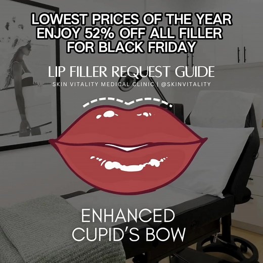 ✨ Black Friday = the Juvederm® event you’ve been waiting for. For a limited time only, get 52% OFF Juvederm® fillers. Add volume, smooth lines, and rejuvenate at the lowest prices of the year. | Skin Vitality Medical Clinic