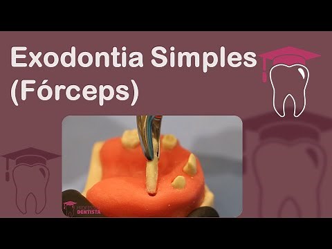 Simple Exodontia (Forceps) - Surgical Technique