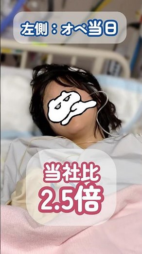 [Did your face swell up after craniotomy?] #moyamoyadisease #moyamoyadisease #cerebralhemorrhage ...