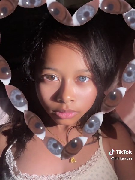 Exploring Heterochromia: Unique Eye Color Trends