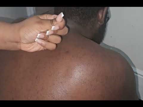 ASMR Back Nitpicking, Massage & White Noise for Deep Relaxation