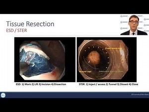Foregut Endoscopic Surgery Overview