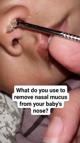 15K views · 65 reactions | What's the best method to remove nasal mucus from their noses? | We Love Babies | Facebook
