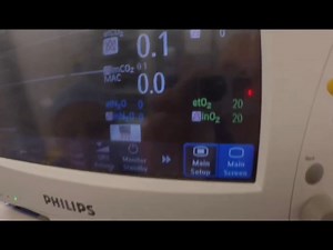 10K views · 163 reactions | Anaesthesia Machine Check; Cockpit Drill @top fans | Khalid's Clinical Anaesthesia | Facebook