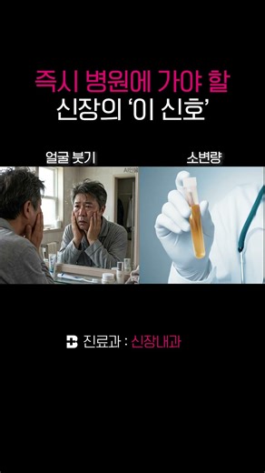 ⚠️즉시 병원에 방문해야 할 신장 신호 #신장내과 #신장질환 #소변
