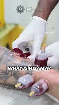 WHAT IS HIJAMA? EXPLAINED!