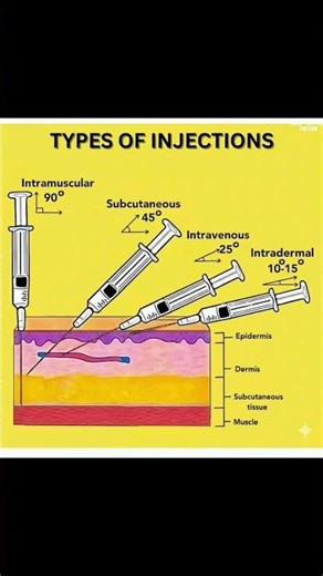 Types Of Injections